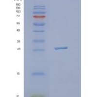 人鸟氨酸脱羧酶抗酶1(OAZ1)重组蛋白