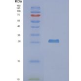 人NUDT5重组蛋白