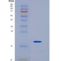 人核运输因子2(NUTF2)重组蛋白