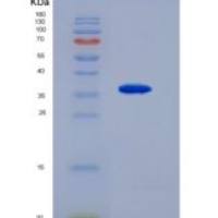 人鸟氨酸转氨酶(OAT)重组蛋白