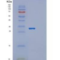 人Otubain 1重组蛋白