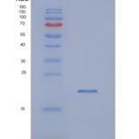 人NUDT4重组蛋白