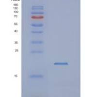 人NUDT4重组蛋白