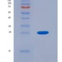 人鸟氨酸氨基甲酰转移酶(OTC)重组蛋白