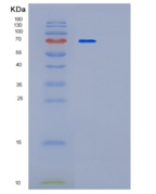 人PAPSS1重组蛋白