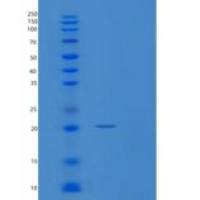 人过氧化还原酶2(PRDX2)重组蛋白