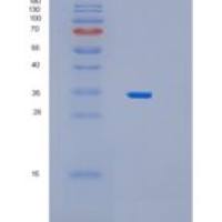 人过氧化物酶体生物合成因子19(PEX19)重组蛋白