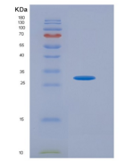 人血小板衍生生长因子受体α(PDGFRa)重组蛋白