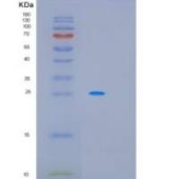 人PCSK1N重组蛋白