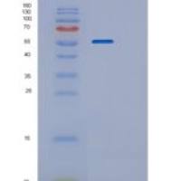 小鼠P4HB重组蛋白