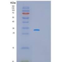 人抗增殖细胞核抗原(PCNA)重组蛋白