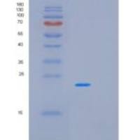 人前妊娠蛋白关联子宫内膜蛋白(PAEP)重组蛋白