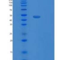 人PELI2重组蛋白