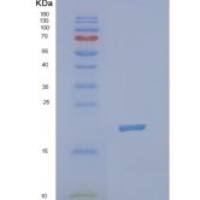 人二磷酸肌醇多磷酸磷酸水解酶1（nudt 3）重组蛋白