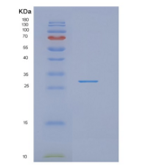 人切割和聚腺苷酸化特异性因子亚单位5（nudt 21）重组蛋