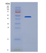 人血小板衍生生长因子D(PDGFD)重组蛋白