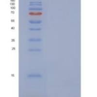 人浦肯野细胞蛋白4样蛋白1（pcp4l 1）重组蛋白