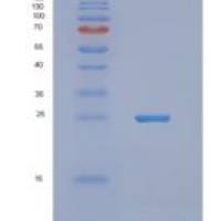 人NUDT16L1重组蛋白