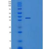 人吡哆醛激酶(PDXK)重组蛋白