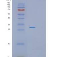 人PDCL3重组蛋白