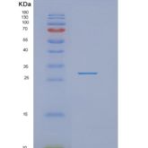 人切割和聚腺苷酸化特异性因子亚单位5（nudt 21）重组蛋白