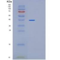 人PARP1重组蛋白