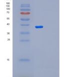 人配对框基因9(PAX9)重组蛋白