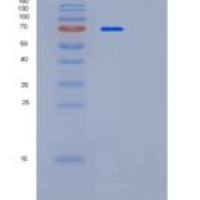 人PAPSS1重组蛋白