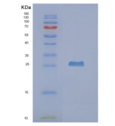 人NUDT5重组蛋白
