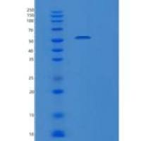人PDIA3重组蛋白