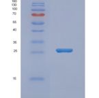 人尿苷二磷酸葡萄糖焦磷酸酶NUDT14重组蛋白