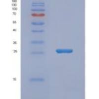 人尿苷二磷酸葡萄糖焦磷酸酶NUDT14重组蛋白