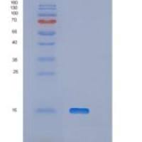 人耳纤维细胞源性蛋白(OTOR)重组蛋白