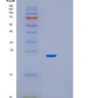 小鼠帕金森氏病蛋白7(PARK7)重组蛋白