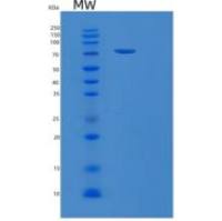 人蛋白二硫化物异构酶A4(PDIA4)重组蛋白