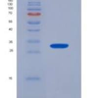 人p21蛋白激活激酶4(PAK4)重组蛋白