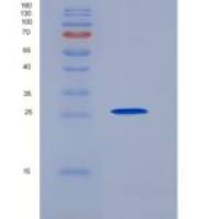 人细胞程序性死亡蛋白1配体2(PDL2)重组蛋白