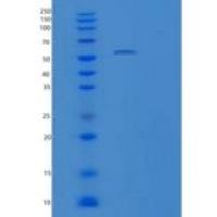 人肽酶D(PEPD)重组蛋白