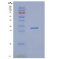 人神经外营养蛋白1(NXPH1)重组蛋白