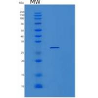 人PCMTD1重组蛋白