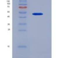 人抑瘤素M(OSM)重组蛋白