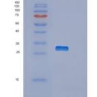 人OTUB2重组蛋白