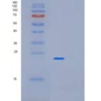 人PABPN1重组蛋白