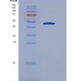 人血小板衍生生长因子D(PDGFD)重组蛋白