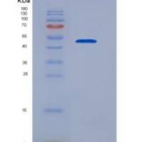 人血小板衍生生长因子D(PDGFD)重组蛋白