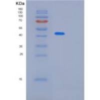 人增殖关联蛋白2G4(PA2G4)重组蛋白