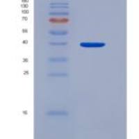 人PDZ和LIM域蛋白1(PDLIM1)重组蛋白