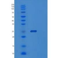 大肠杆菌sodA重组蛋白
