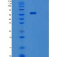 人PDZK1重组蛋白