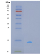 人细胞程序性死亡蛋白5(PDCD5)重组蛋白